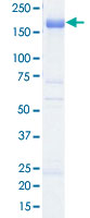 Loading 1 &mu;g protein in SDS-PAGE